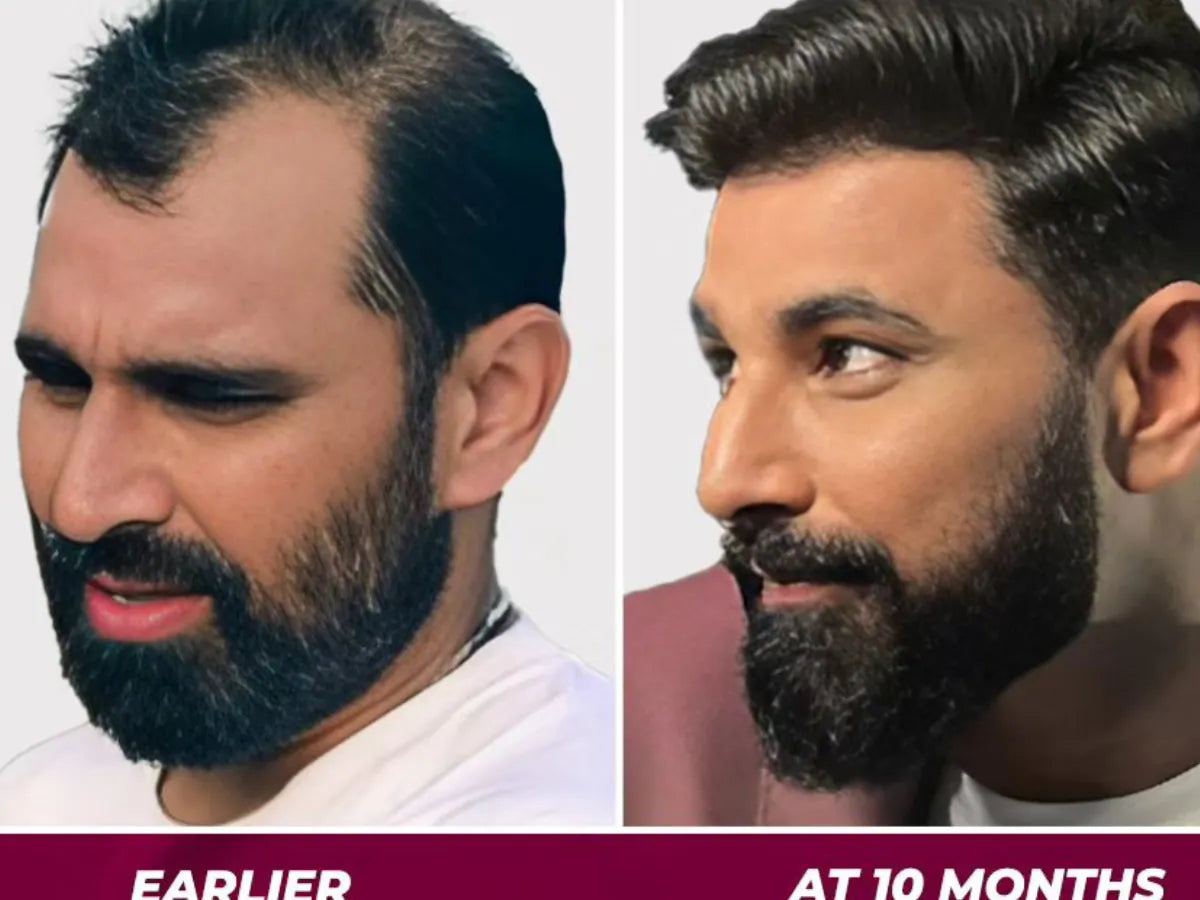 🌿 Jamalgota Ayurvedic Hair Growth Powder Buy 1 Get 1 Free🔥